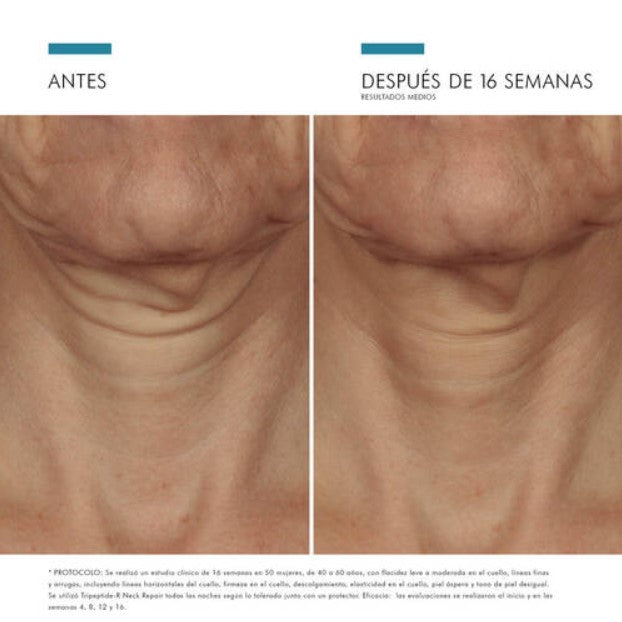 Skinceuticals Tripeptide-R Neck Repair (50ml)
