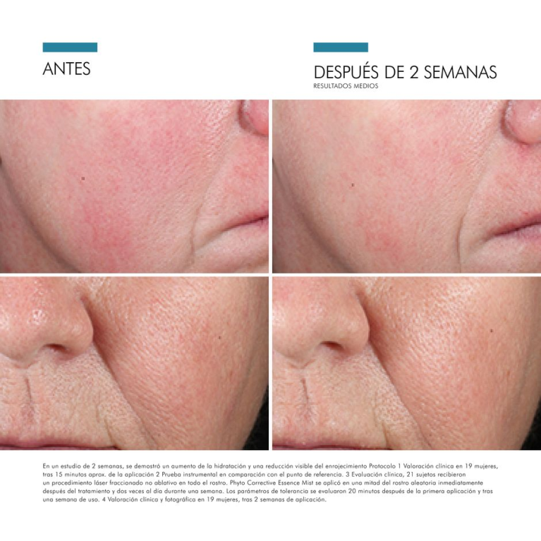 Skinceuticals Phyto Corrective Essence Mist (50ml)+REGALO: HA Intensifier Multi-Glycan (15ml) + 2x A.G.E Interrupter Advanced (3ml)