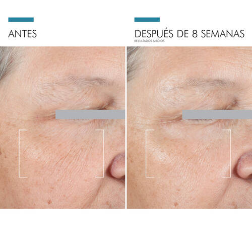 AGE Advanced Eye (15ml)