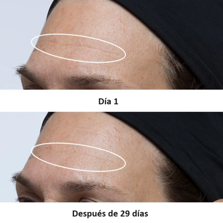 Perricone MD Cold Plasma + Facial (30ml)