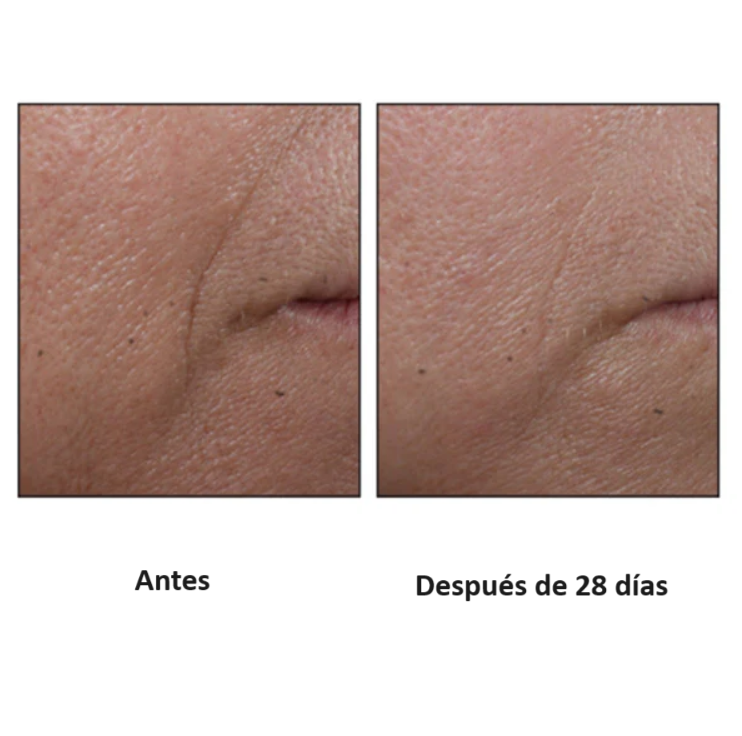 Perricone MD Cold Plasma + Facial (30ml)