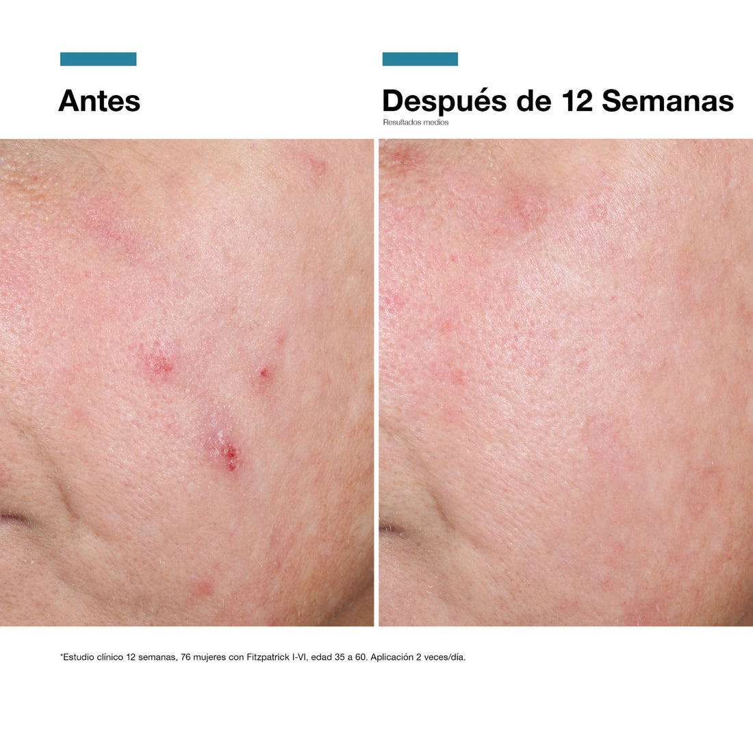 Skinceuticals Advanced RGN-6 (30ml)