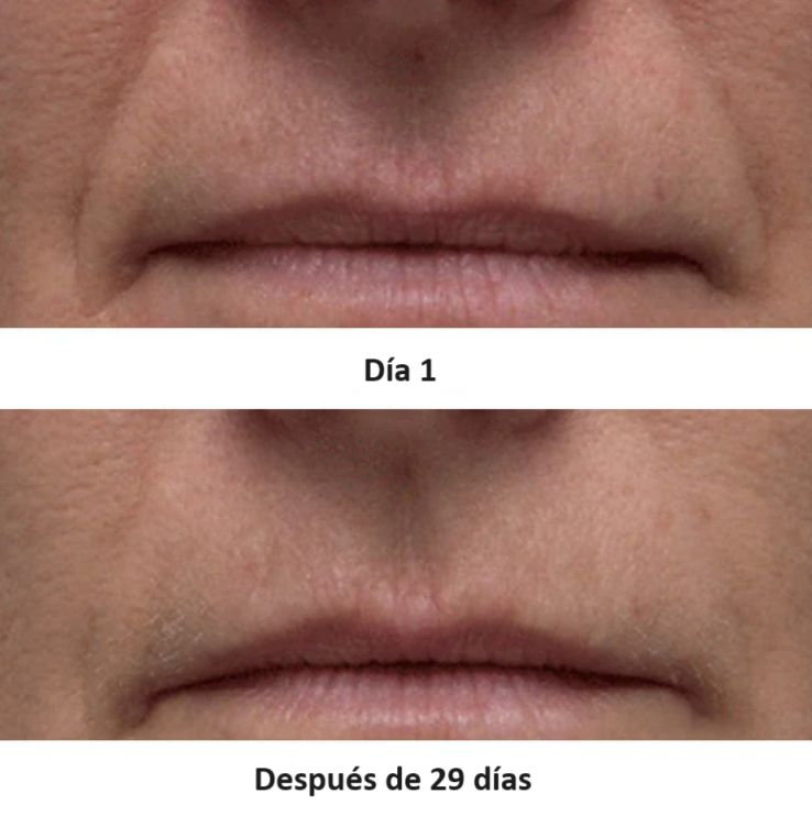 Perricone MD Cold Plasma + Facial (30ml)