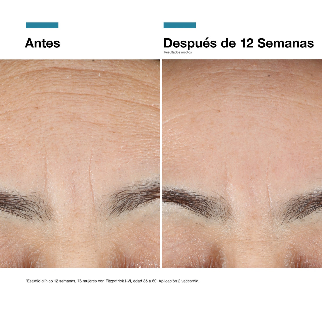 Skinceuticals Advanced RGN-6 (30ml)