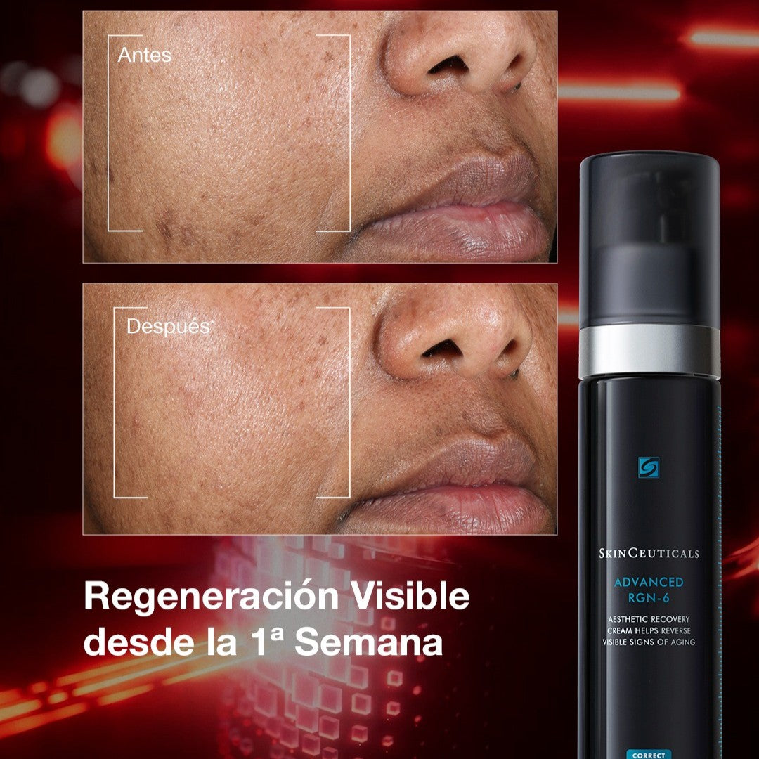 Skinceuticals Advanced RGN-6 (30ml)